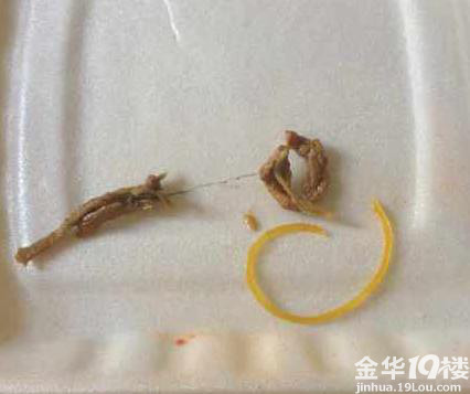浦江饭菜大全的医院外送头发和橡皮筋-我要爆名字人民后女生90图片