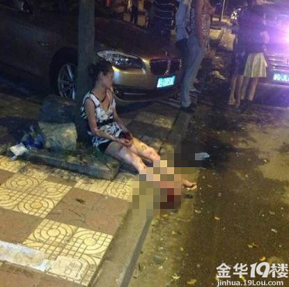 义乌一老板娘刚接手一家饭店 被煤气严重炸伤