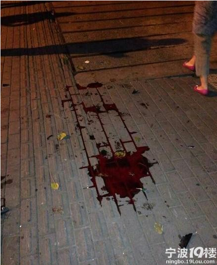 精神障碍,无刑事责任能力,故免于追究其刑事责