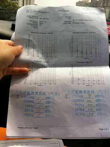 聋哑孩子7个月大,上海复旦大学附属医院证-结