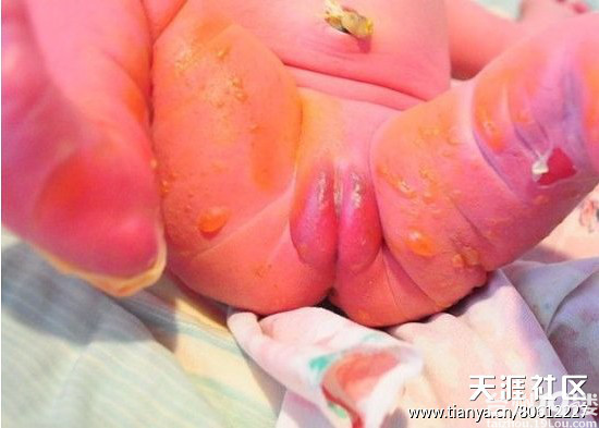 小孩洗浴被烫的大哭!护士说没事儿!-我听说的-