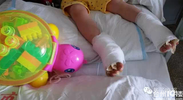 三岁孙子脚痒不愿穿鞋,奶奶给泡脚泡出祸!-活动