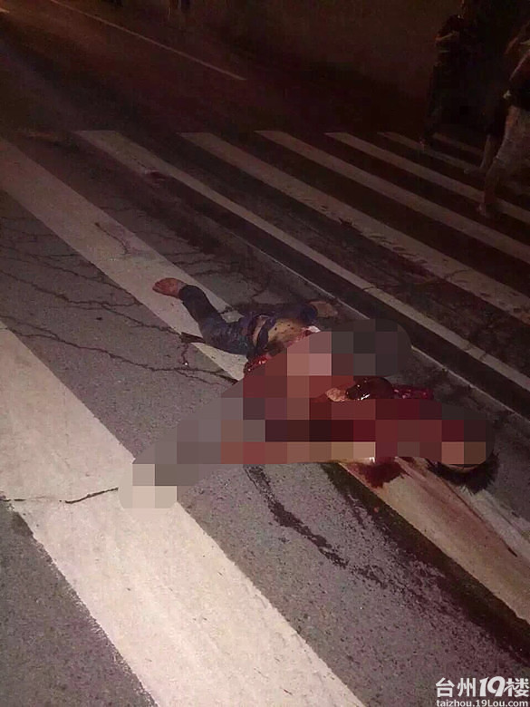 椒江开发大道发生重大事故,手断了心肺都挂在