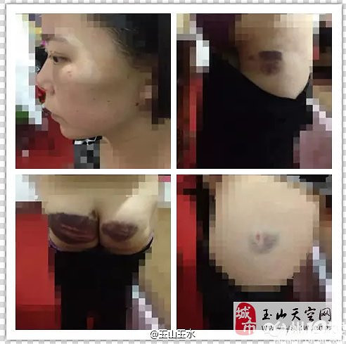  女子 三点式裸奔街头 实为 连生 两 女儿 为其夫所