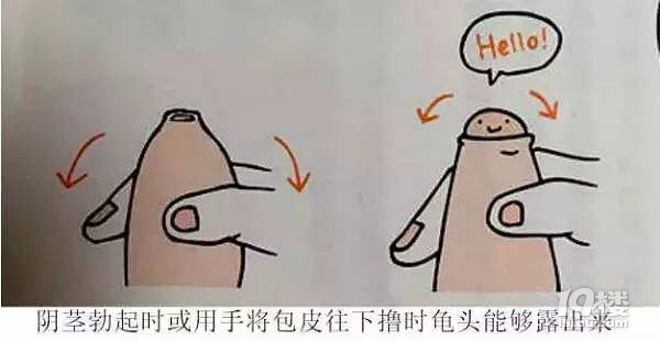 孩子割包皮这件事，影响很严重！家长必看