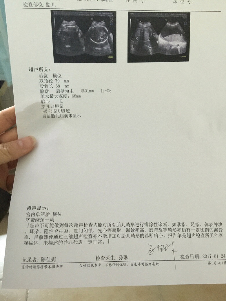 �ȴ�һ�������������Ĳ����ס�