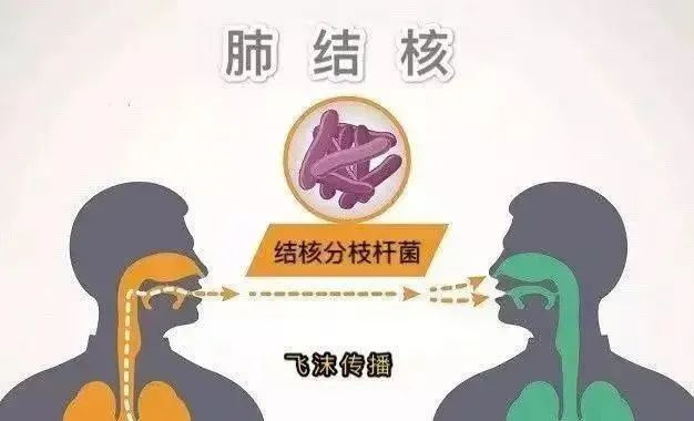 本月起,台州首次启动新生入学结核病全面筛查