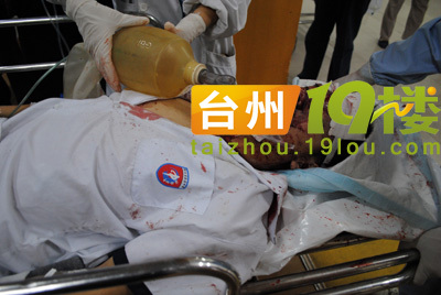 温岭实验中学一学生坠楼-讲白搭-台州19楼