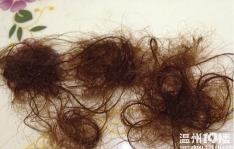 昨天<em>染</em>个<em>头发</em> 今天<em>洗头</em>发现<em>头发</em>都快掉完了55