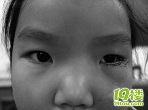 女孩受伤眼睛恢复视力了-早知道-温州散讲-温州