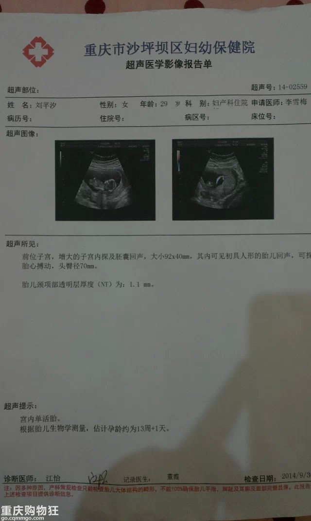 10月怀胎宝宝成长记（电梯直达，更新至9个月）O(∩_∩)O~~