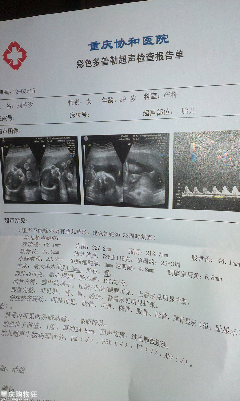 10月怀胎宝宝成长记（电梯直达，更新至9个月）O(∩_∩)O~~