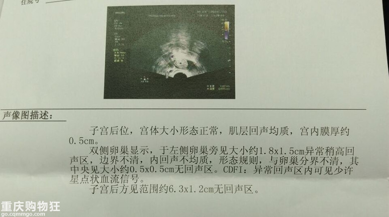 迟来的宝宝却还是让上天收了去！
