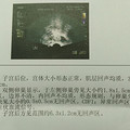 迟来的宝宝却还是让上天收了去！