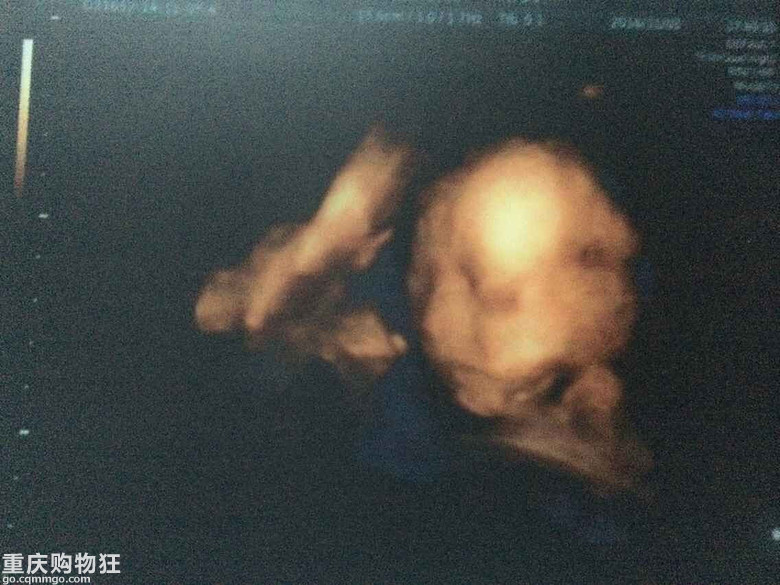 豆豆妈妈纠结的备孕、怀孕、生产、哺乳、购物贴(超详细)