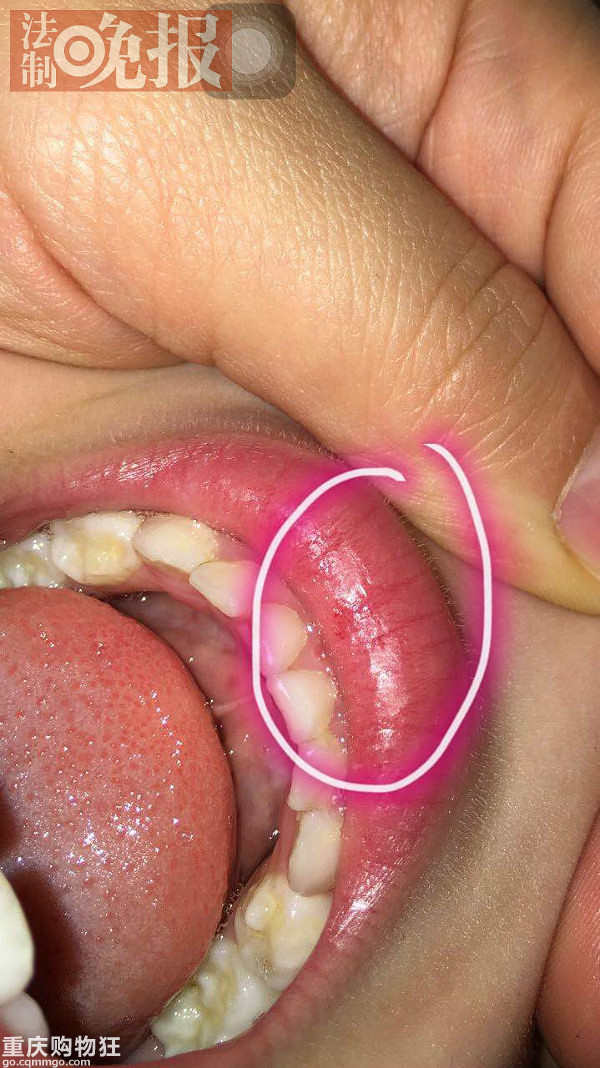30名幼儿遭老师针扎，外地的红黄蓝幼儿园出事了！！