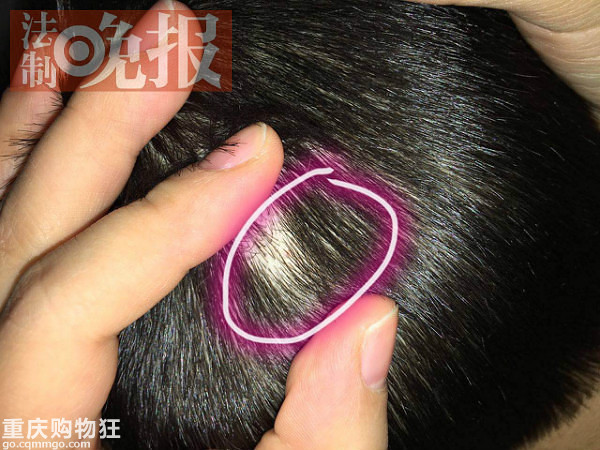 30名幼儿遭老师针扎，外地的红黄蓝幼儿园出事了！！