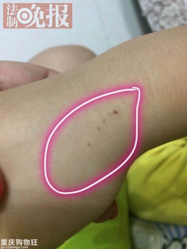 30名幼儿遭老师针扎，外地的红黄蓝幼儿园出事了！！