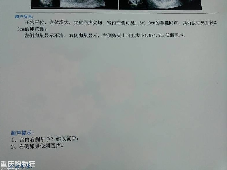 今天真的是心都凉了！！！！楼主怀孕51天，