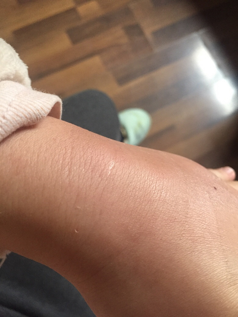 ���׵�����