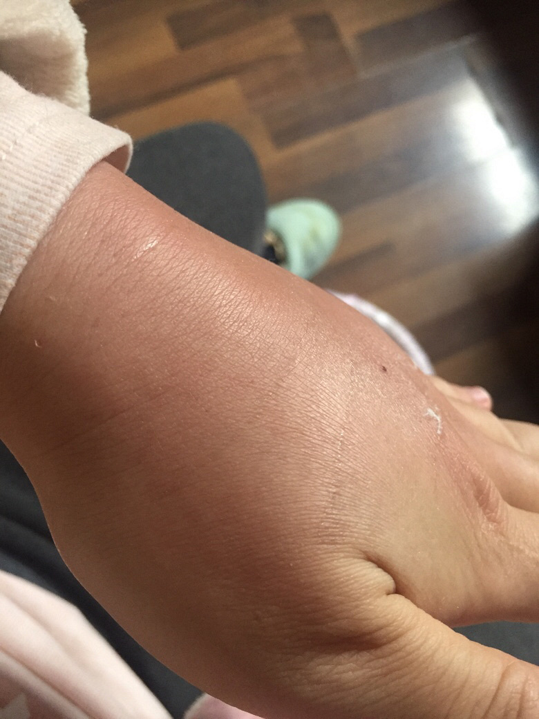 ���׵�����