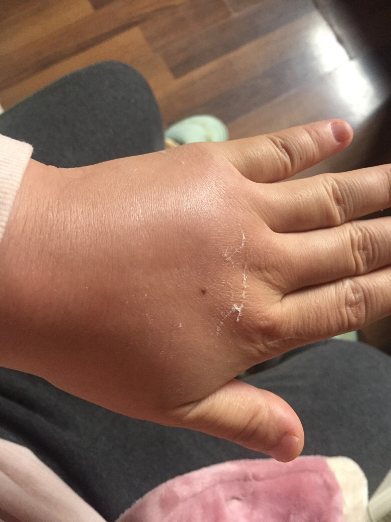 ���׵�����