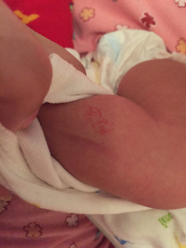 Ѫ������ô��