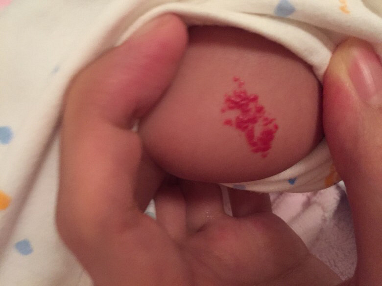 Ѫ������ô��