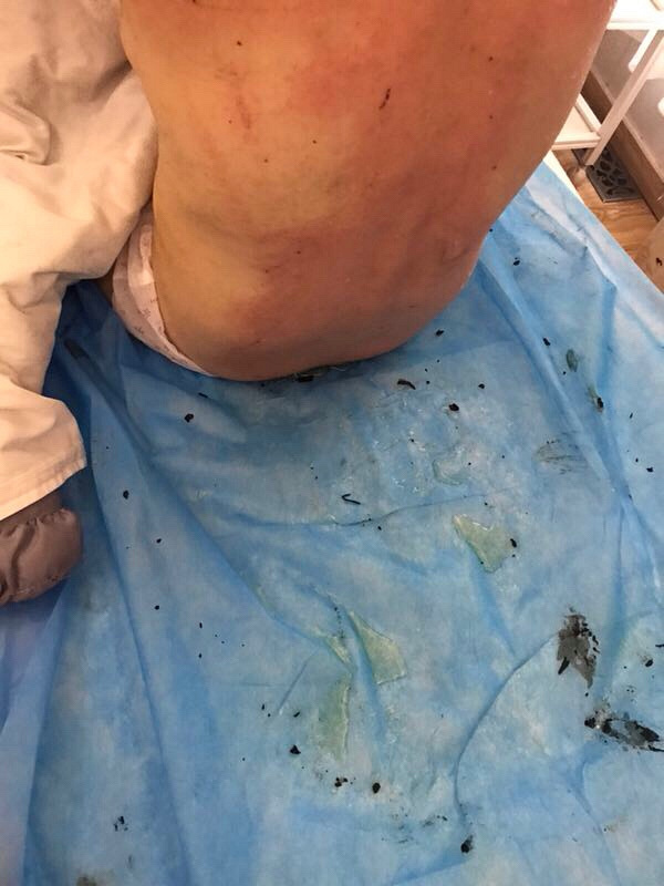 产后恢复是女人恢复的重要时期一一重庆月子之家