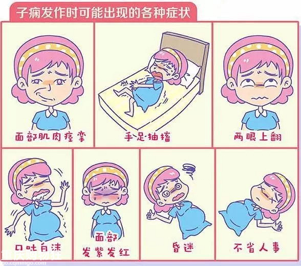 妊娠子痫，孕妈和胎儿的夺命魔咒【孕期龙门阵】