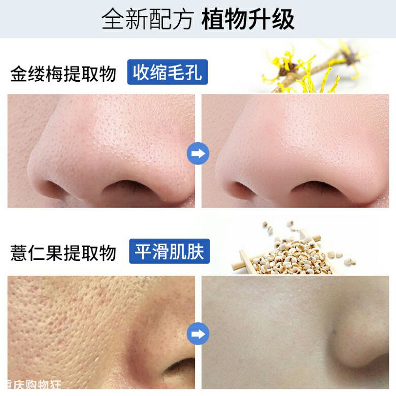 收敛毛孔的VC爽肤水领券只要￥5.1，不要太划算