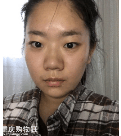 隆鼻不可怕，一直丑才可怕+【变美日记】