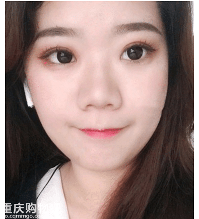 隆鼻不可怕，一直丑才可怕+【变美日记】
