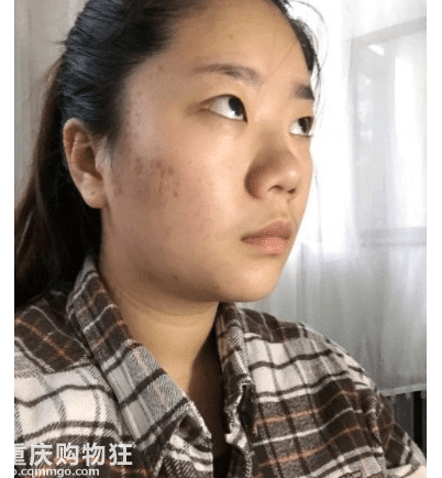 隆鼻不可怕，一直丑才可怕+【变美日记】