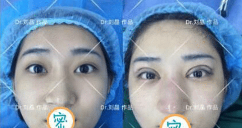 �ɶ���˫��ƤΪʲô�۸�β�룬����ҽ��Ϊ��ҽ���