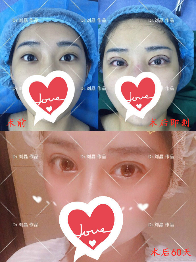 �ɶ���˫��ƤΪʲô�۸�β�룬����ҽ��Ϊ��ҽ���