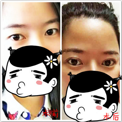 �ɶ�����˫��Ƥ��������λ����أ�