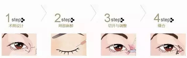 �ɶ���˫��Ƥ����ã�˫��Ƥ����֮����ƪ