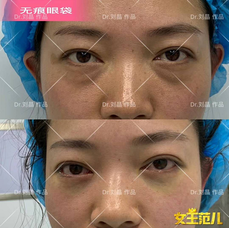 �ɶ�����ȥ�۴��ã�������Ϊʲô��������ȥ�۴��������������ϣ�