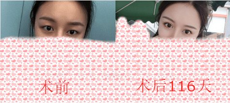 ɶ˫ƤƼҽɶܣ˫Ƥע