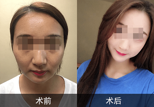 Ϻ沿Ϻ沿ҪǮЧô