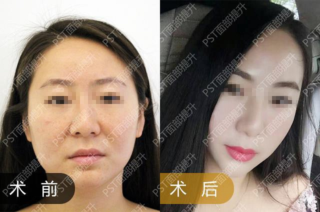 �Ϻ��沿��������ã����������Σ��������ºۼ��ػ�����_