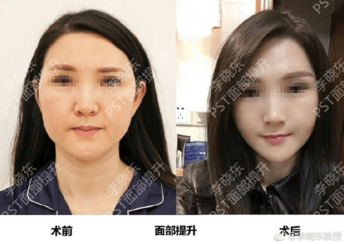 Ƥ���ɳڻᵼ����Щ�仯?����������Ϊ��ҽ���