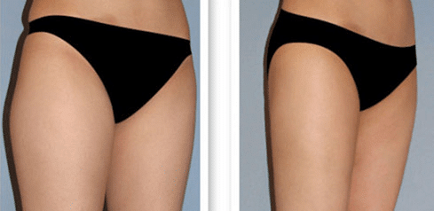 �ɶ�֬���ʣ���֬ҽԺ��������������ģ�