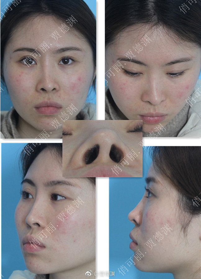 �ɶ�����¡�ǣ��ֵ�Ԩ¡��