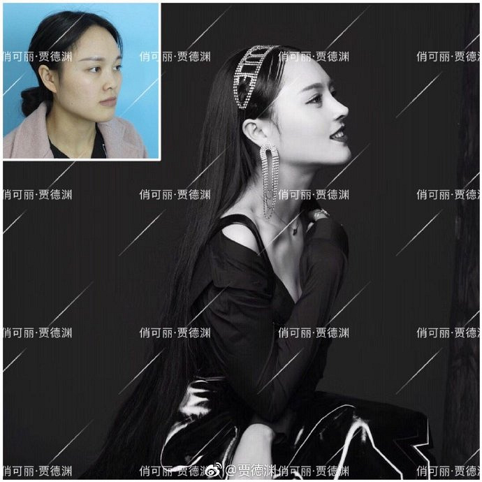 �ɶ�����¡�ǣ��ֵ�Ԩ¡��