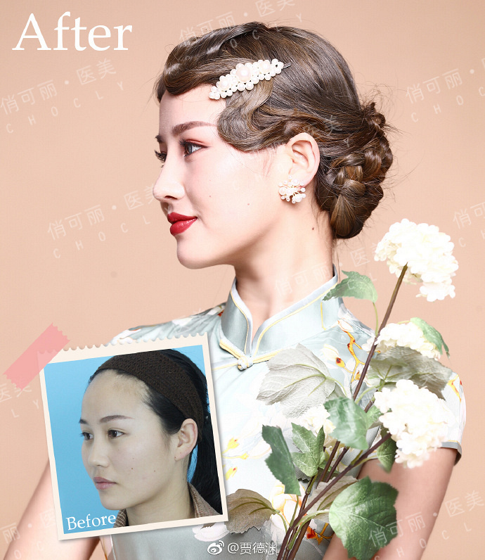 �ɶ�����¡�ǣ��ֵ�Ԩ¡��