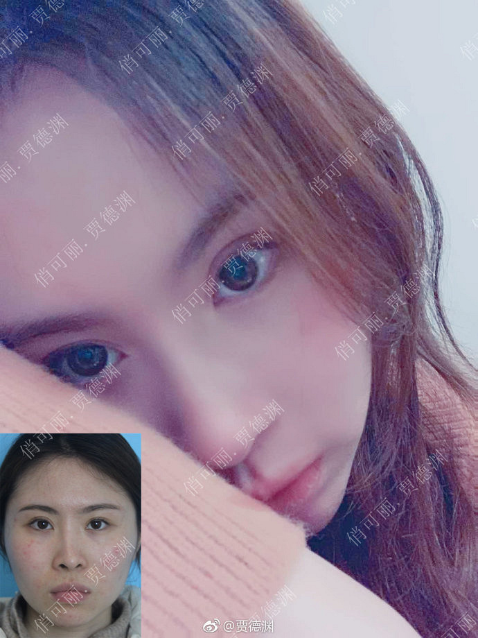 �ɶ�����¡�ǣ��ֵ�Ԩ¡��