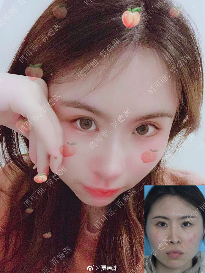 �ɶ�����¡�ǣ��ֵ�Ԩ¡��