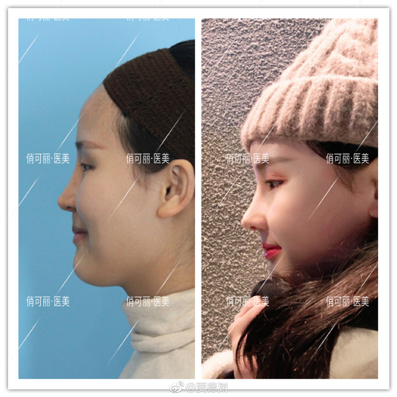 �ɶ�������¡��ҽ�������ռֵ�Ԩ��ô��